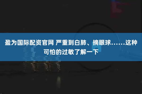 盈为国际配资官网 严重到白肺、摘眼球……这种可怕的过敏了解一下